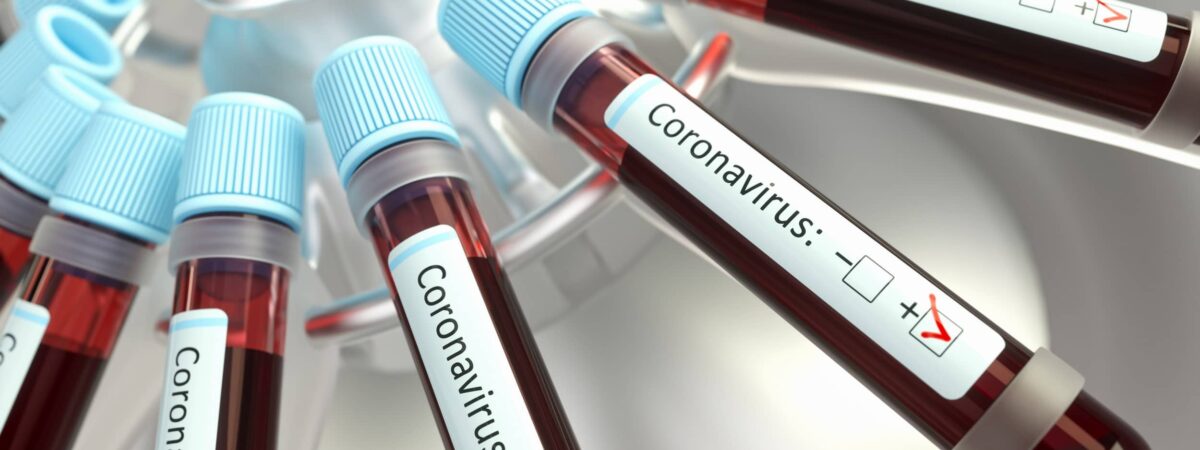Coronavirus - © ktsimage